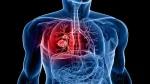 Mỹ phê duyệt thuốc mới điều trị ung thư phổi di căn