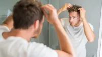 5 thói quen ăn uống xấu có thể gây rụng tóc