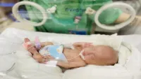 Em bé đầu tiên tại Việt Nam chỉ nặng 0,4 kg khi chào đời