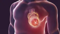 Tăng nguy cơ tim mạch ở người bệnh ung thư dùng liệu pháp nội tiết