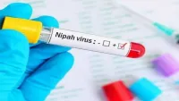 Virus Nipah bùng phát tại Ấn Độ có nguy hiểm hơn SARS-CoV-2?